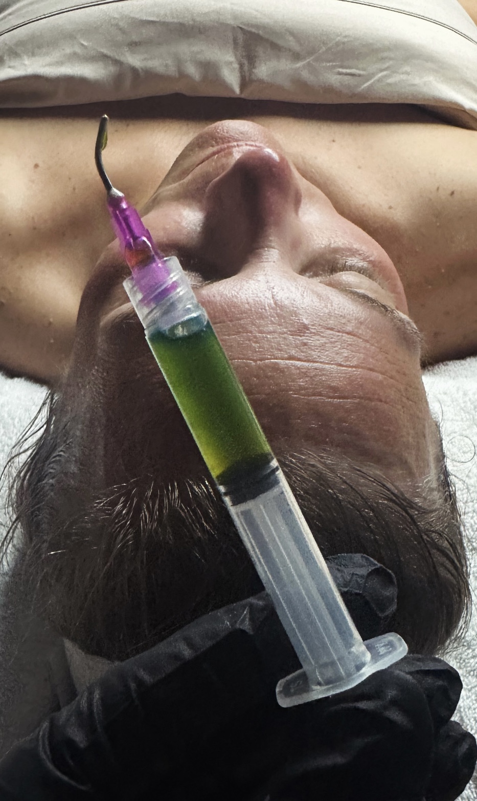 Professional serum treatment being applied during a facial